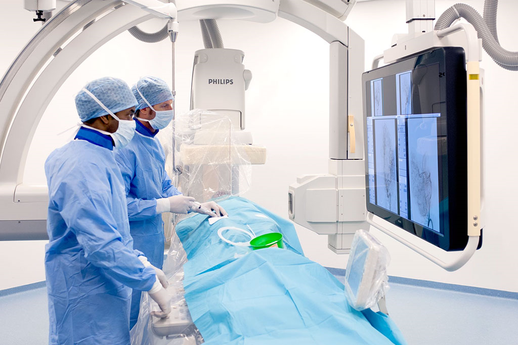 آنژيوگرافي (عکس برداری از رگ های قلب)